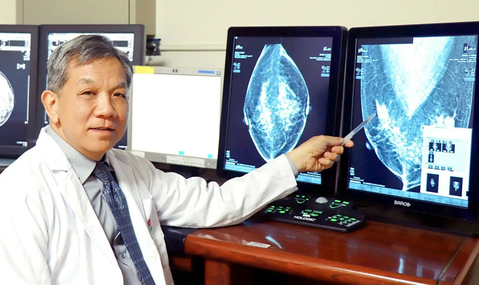 聖馬升級3D乳房攝影同步導入AI　乳癌篩檢更精準舒適