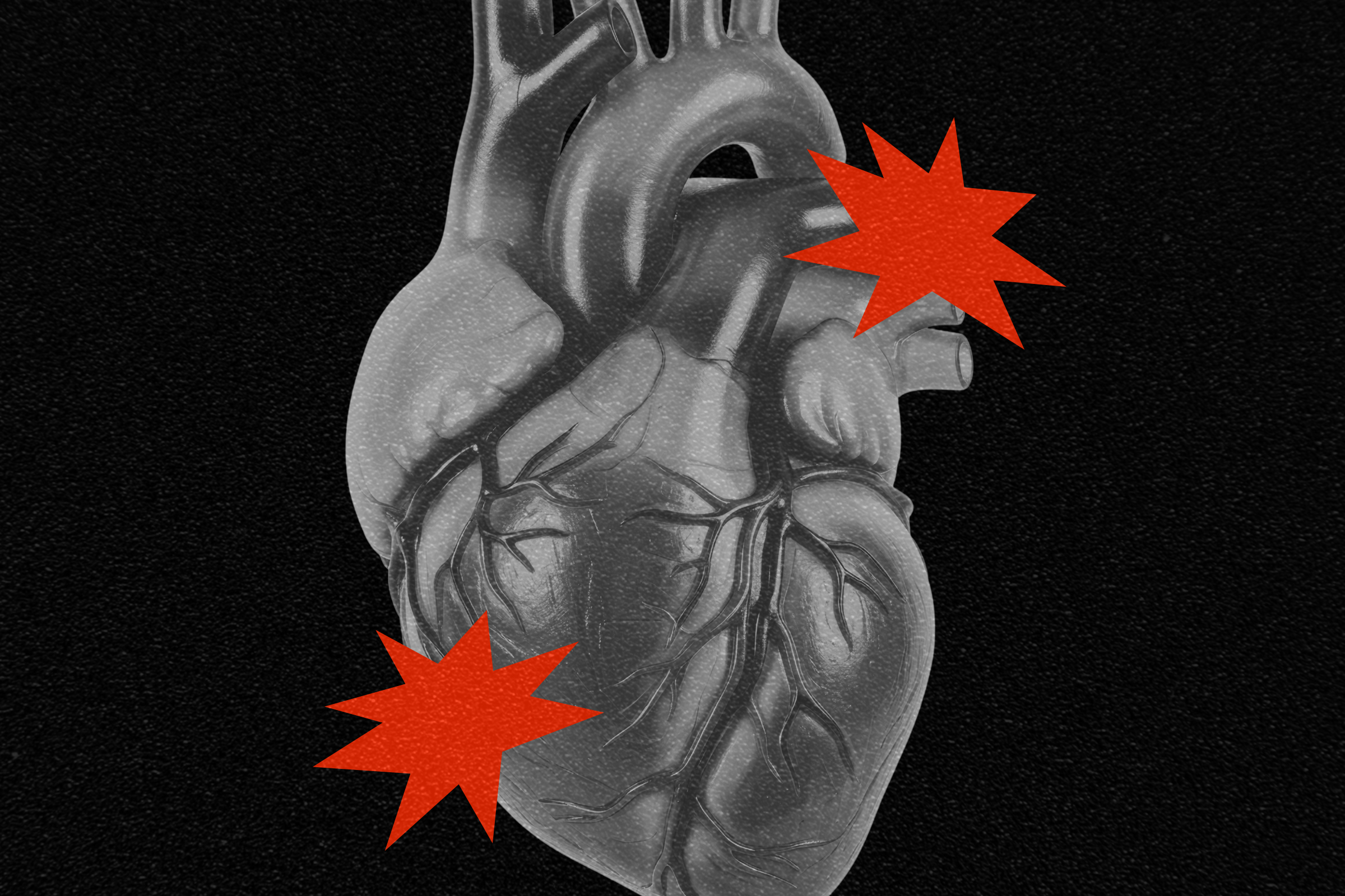 The New Technique to Predict Your Threat of a Coronary heart Assault