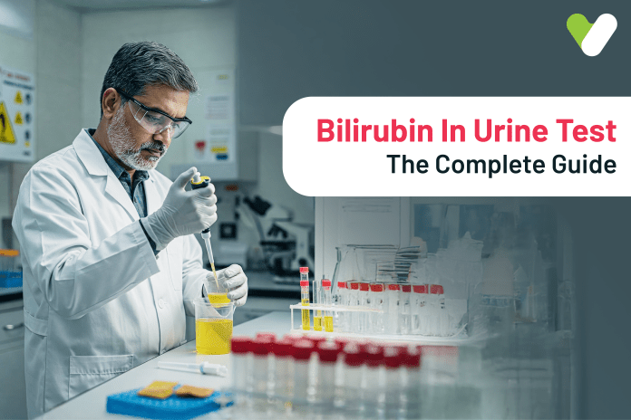 Bilirubin In Urine Test