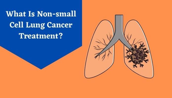 Treatments of Lung Cancer