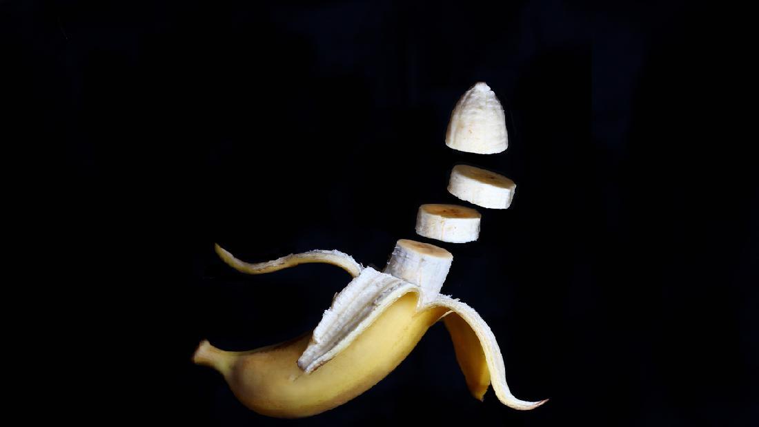 Awalnya Cuma Ngeluh Memar, Mr P Pria Ini Diamputasi gegara Kanker Penis