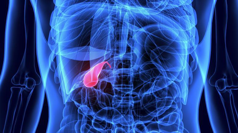 Dokter Ungkap Makanan yang Bisa Picu Batu Empedu, Sebaiknya Dibatasi