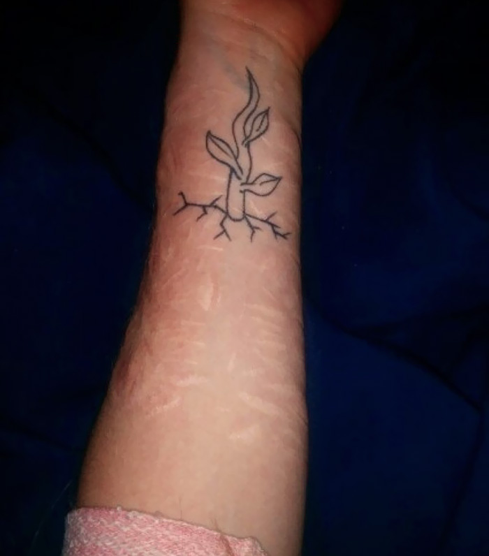 137 Cool Ideas For Hiding Scars With Tattoos - Body Art Guru