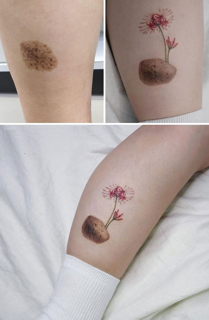 137 Cool Ideas For Hiding Scars With Tattoos - Body Art Guru 1072_x_700_jpg