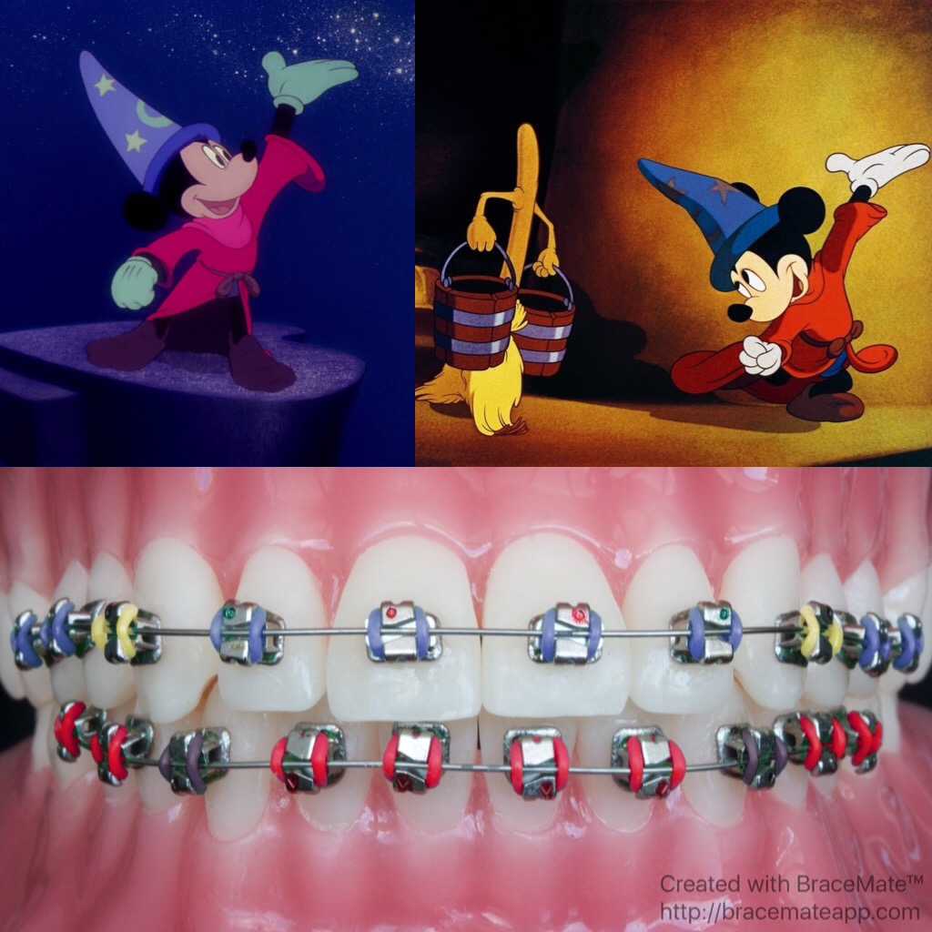 Mickey mouse braces