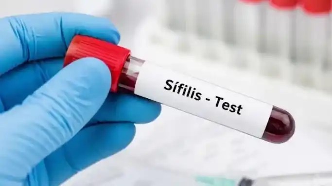 Alerta por el aumento de casos de sífilis en Argentina: crecieron un 26% entre las mujeres