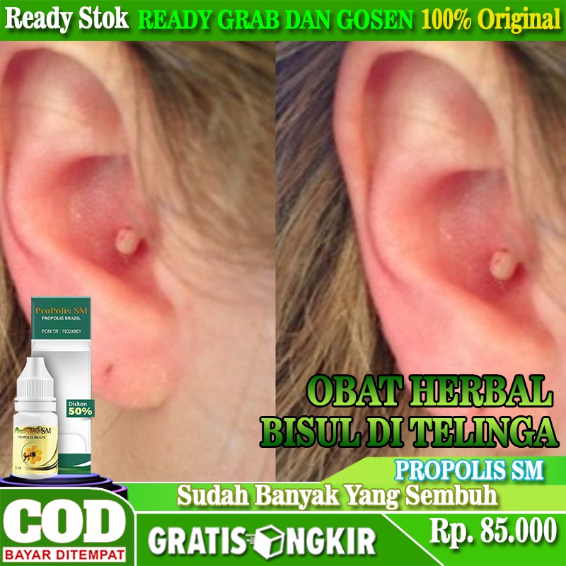 Harga Bisul Telinga Terbaru Oktober 2021 | BigGo Indonesia