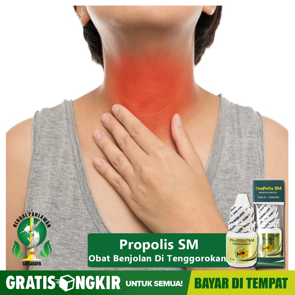 Obat benjolan di tenggorokan, di leher, di dahi, di area intim Propolis SM  Brazzilian Original COD | Shopee Indonesia