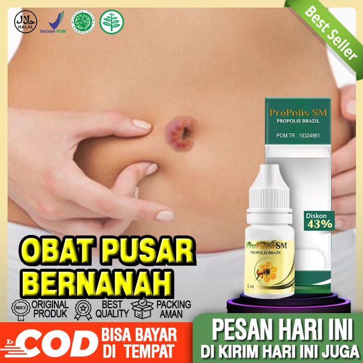Jual Obat Pusar Bernanah, Infeksi Di Pusar, Pusar Berair - ProPolis SM  Indonesia|Shopee Indonesia