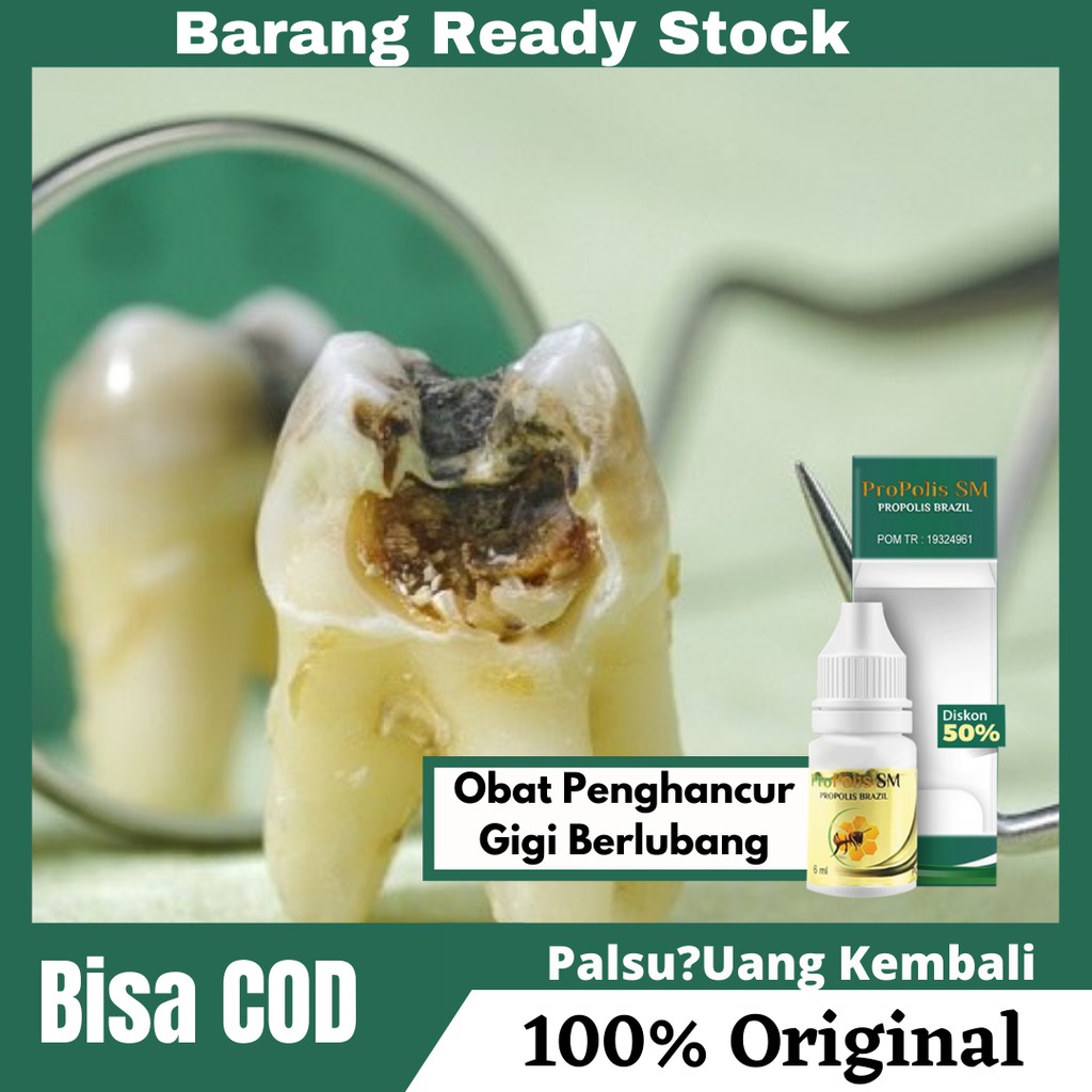 Harga Gigi Berlubang Hitam Terbaru Oktober 2021 | BigGo Indonesia