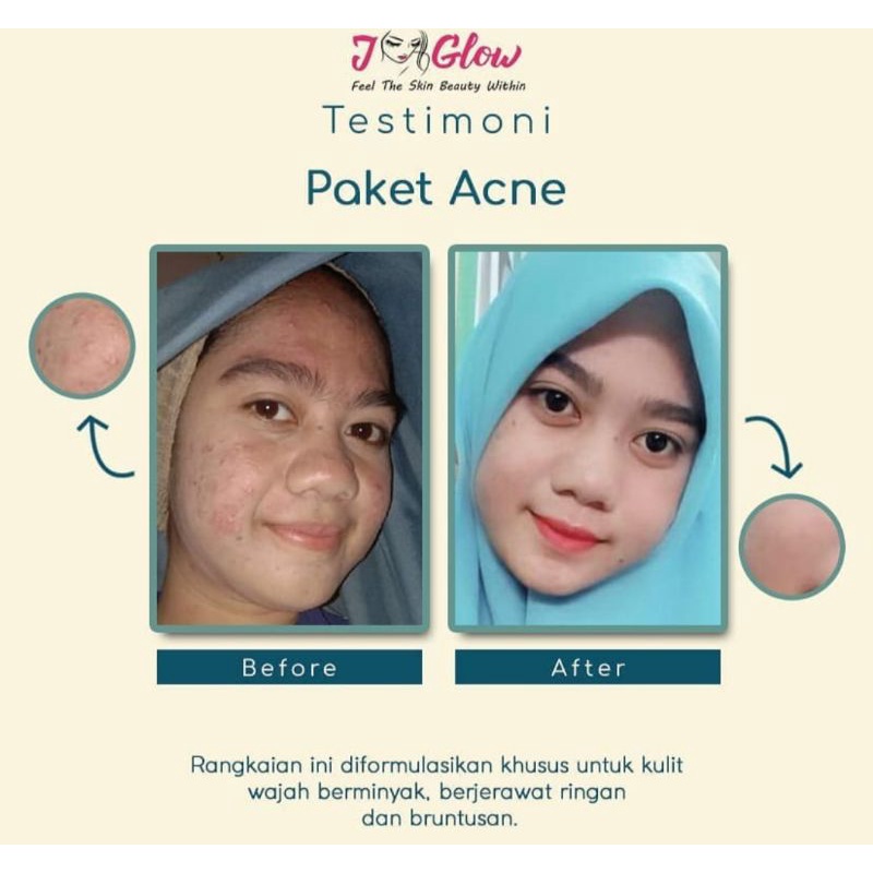 orderan mbak lia | Shopee Indonesia