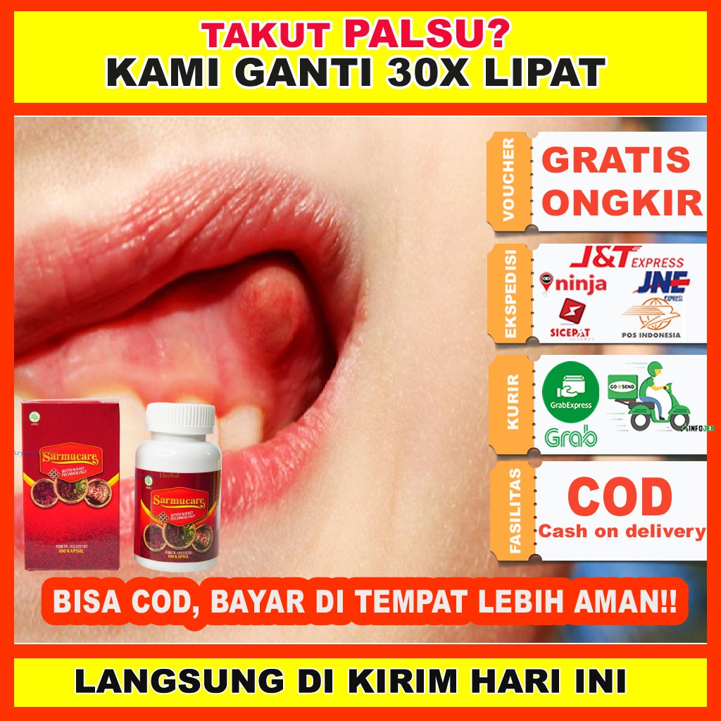 Jual Obat Benjolan Gusi/ Gusi Bengkak/ Penghilang Benjolan Alami/ Kapsul  Sarang Semut Papua Putih Asli Indonesia|Shopee Indonesia