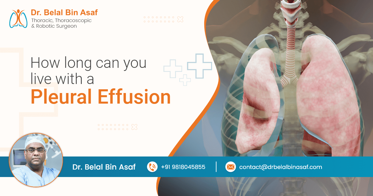 How Long can You Live with Pleural Effusion