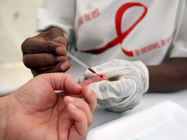 Mitos y verdades sobre el VIH/SIDA: cómo prevenir y vivir con la enfermedad