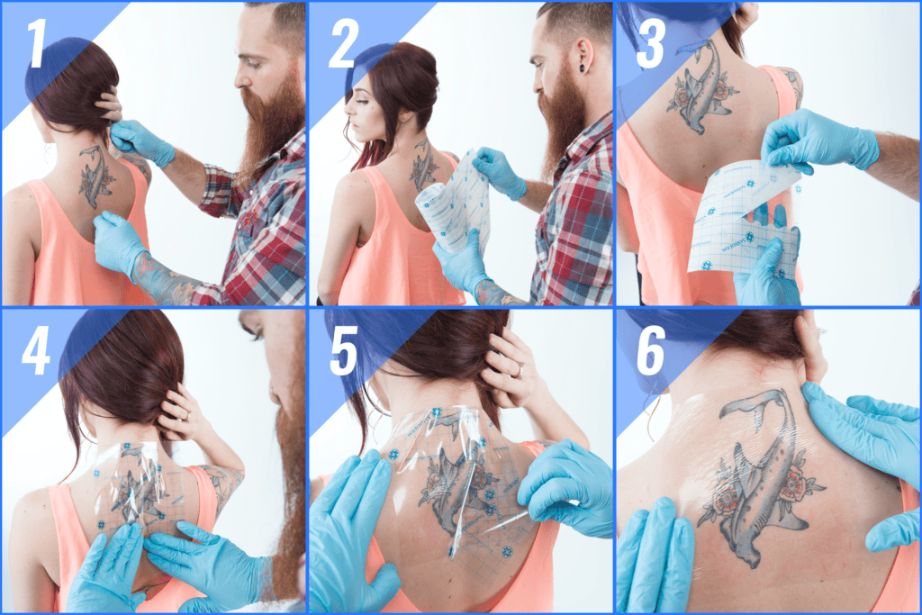 How Does Saniderm Work? – Saniderm Knowledge Base 683_x_1024_png