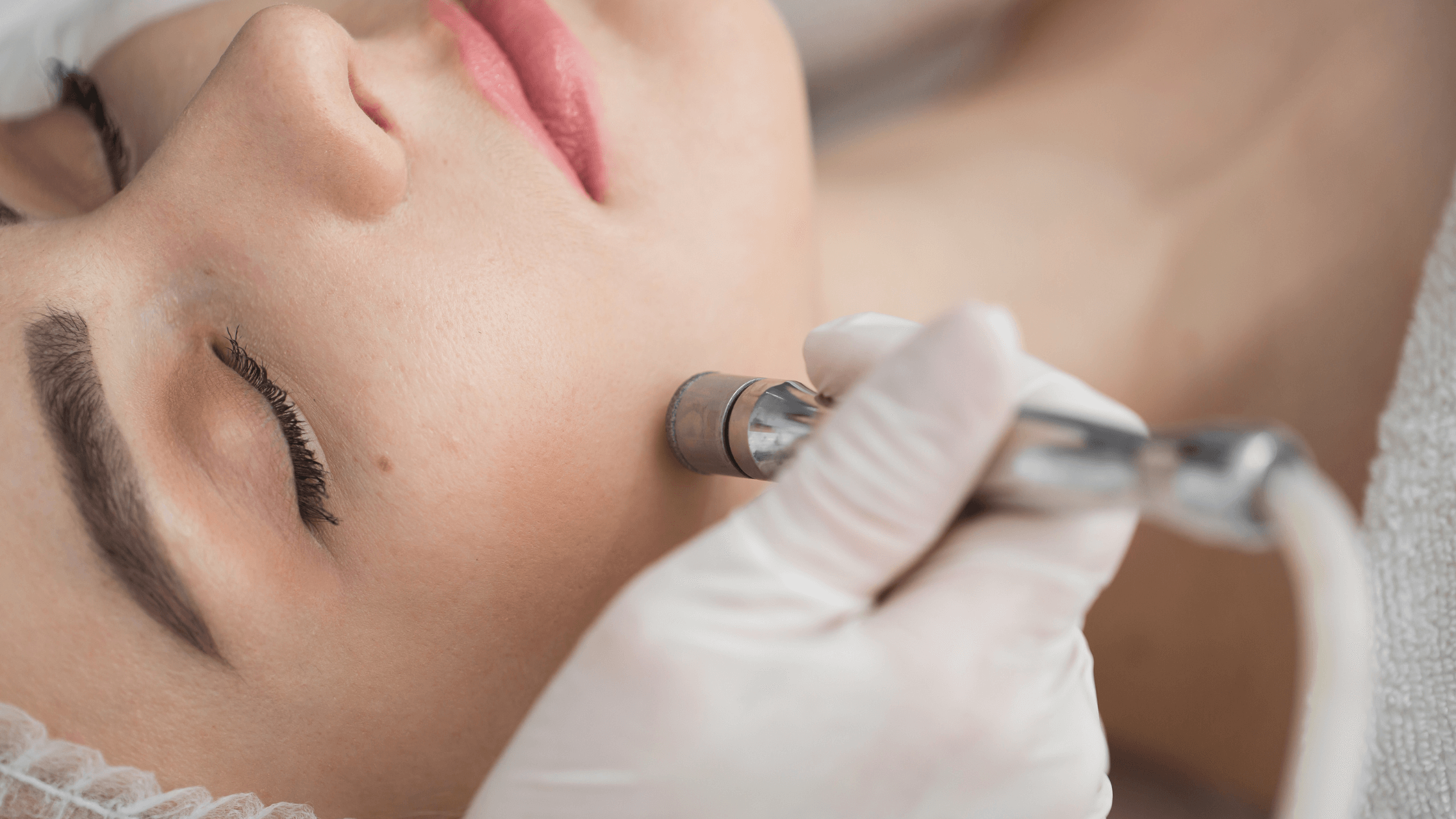 Microlaser Peel,Chemical Peel,Microlaser Peel vs. Chemical Peel