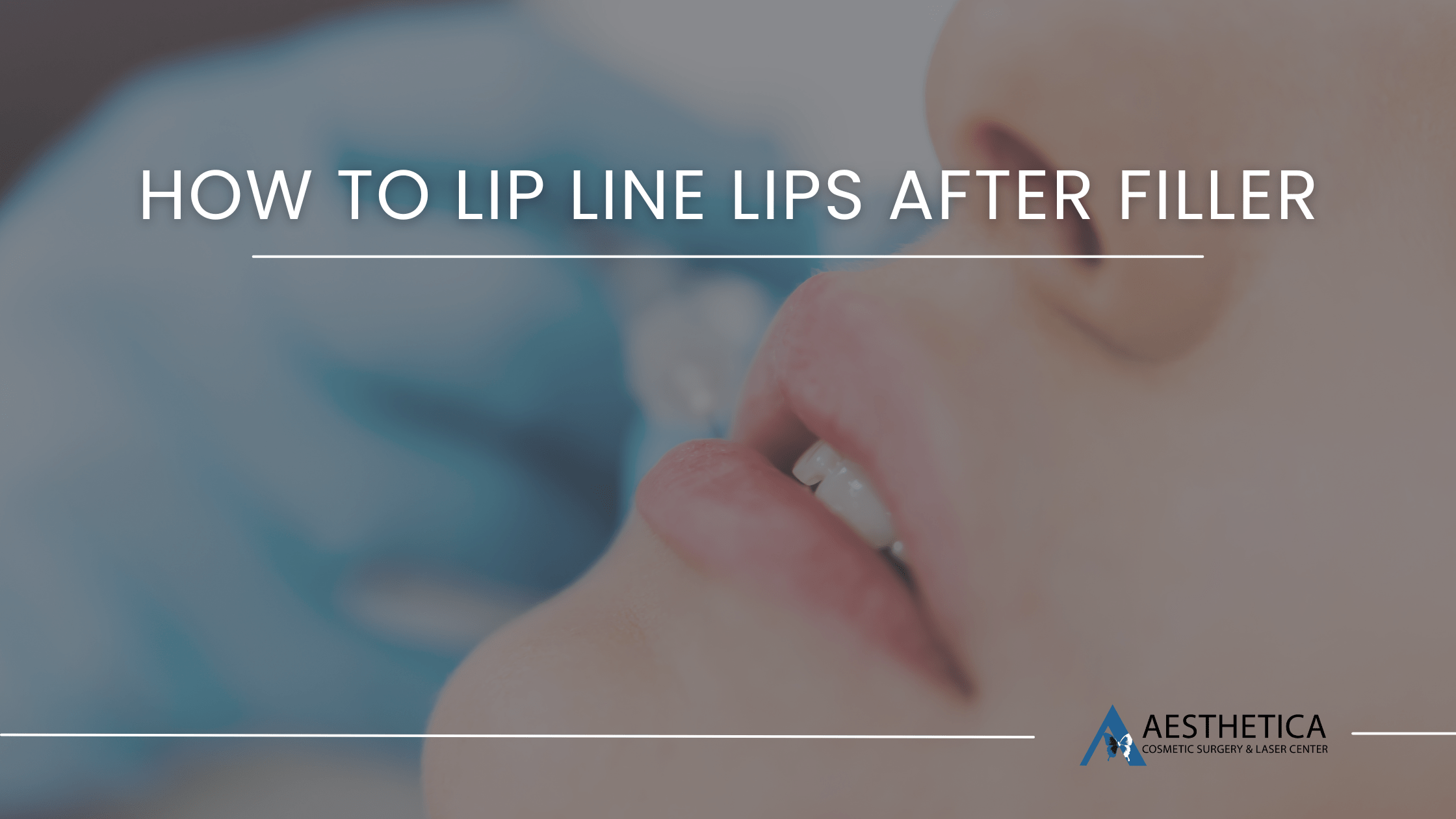 Lips Post-Filler,Post-Lip Filler Procedure,Altered Lip Sensation and Precision,Dealing with Swelling,Maintaining Symmetry on Enhanced Lips,Adjusting to the New Lip Shape,Selecting the Right Lip Liner,Lip Fillers,line,lip line,line your lips