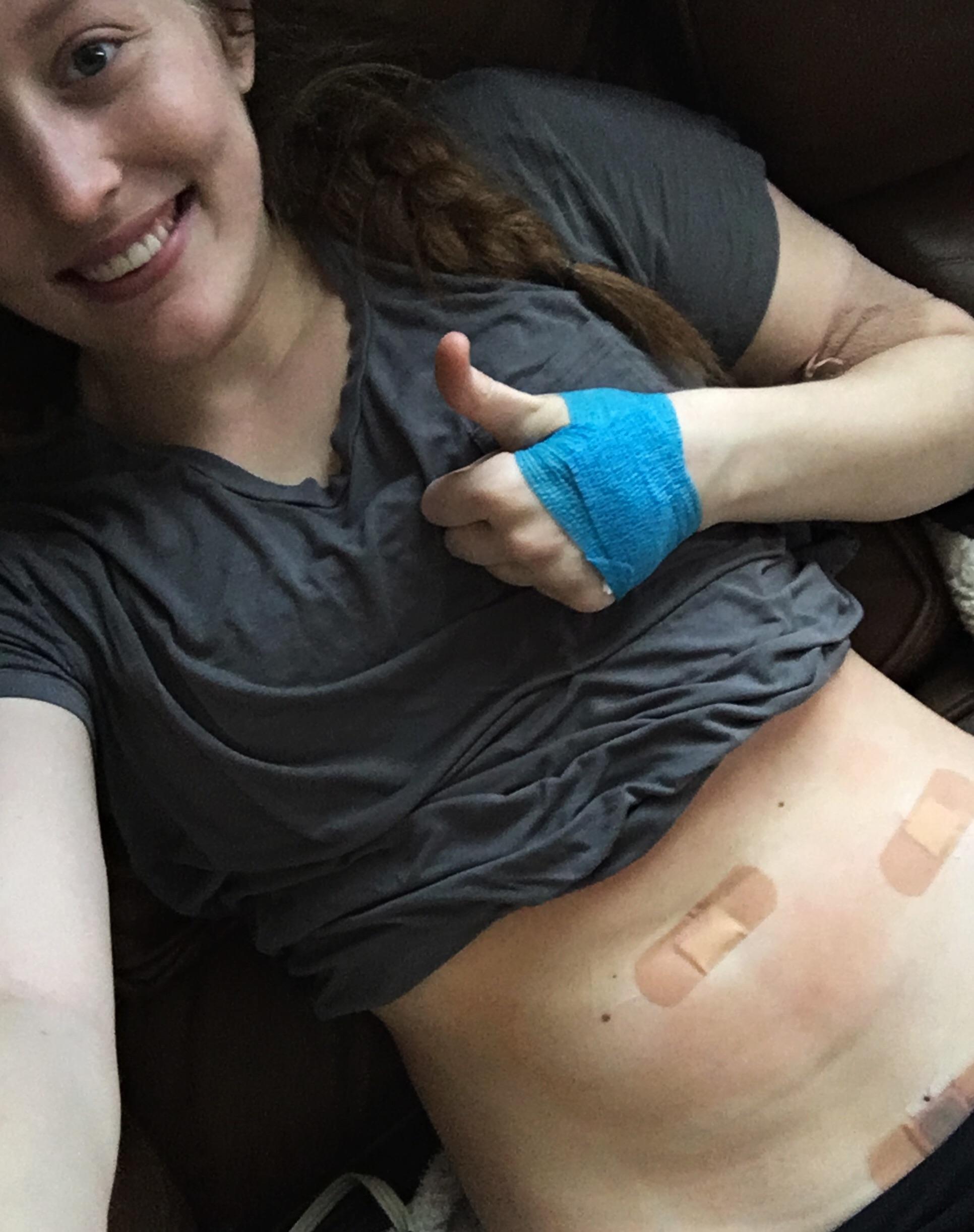 Reddit tubal ligation