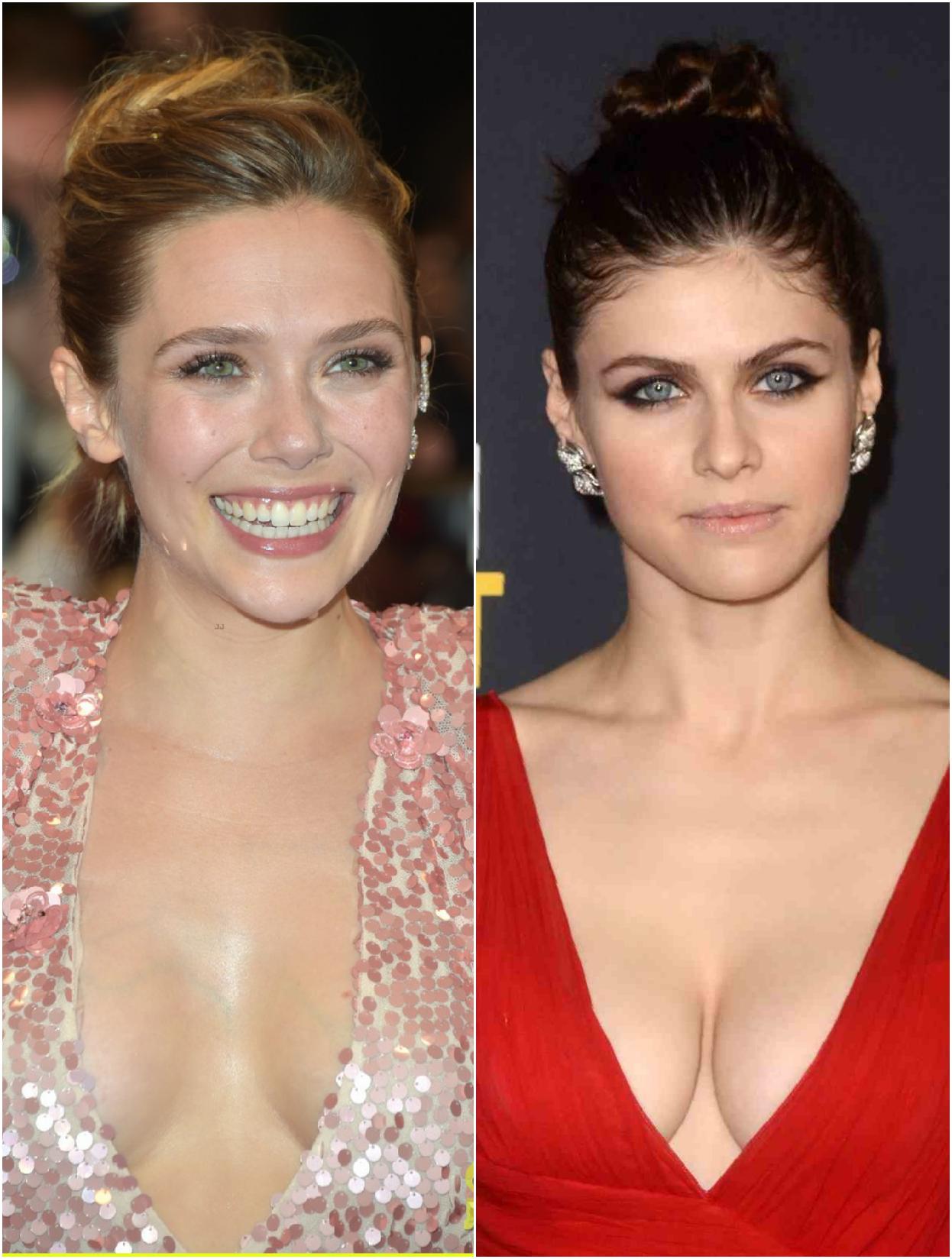 Elizabeth olsen implants