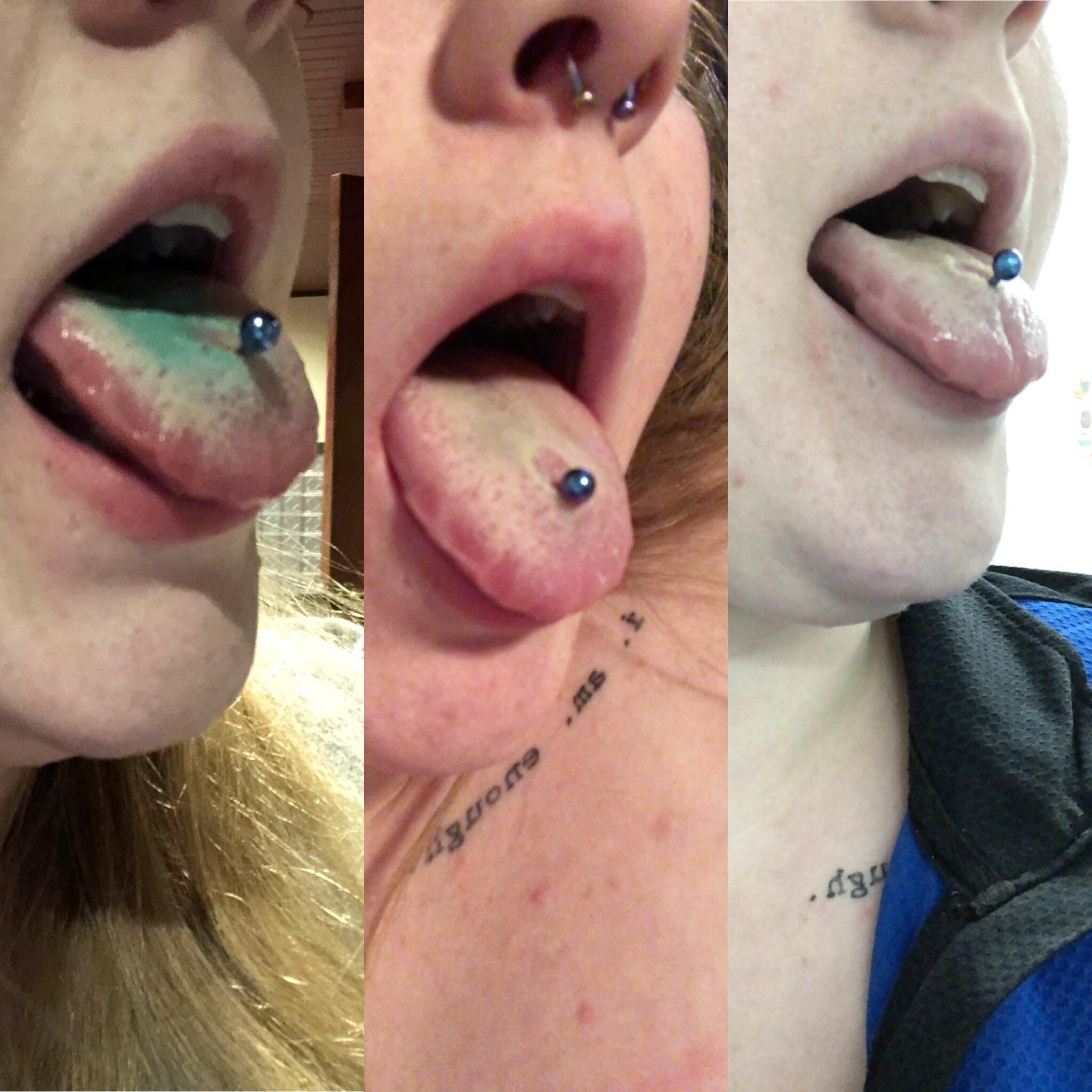 Progression