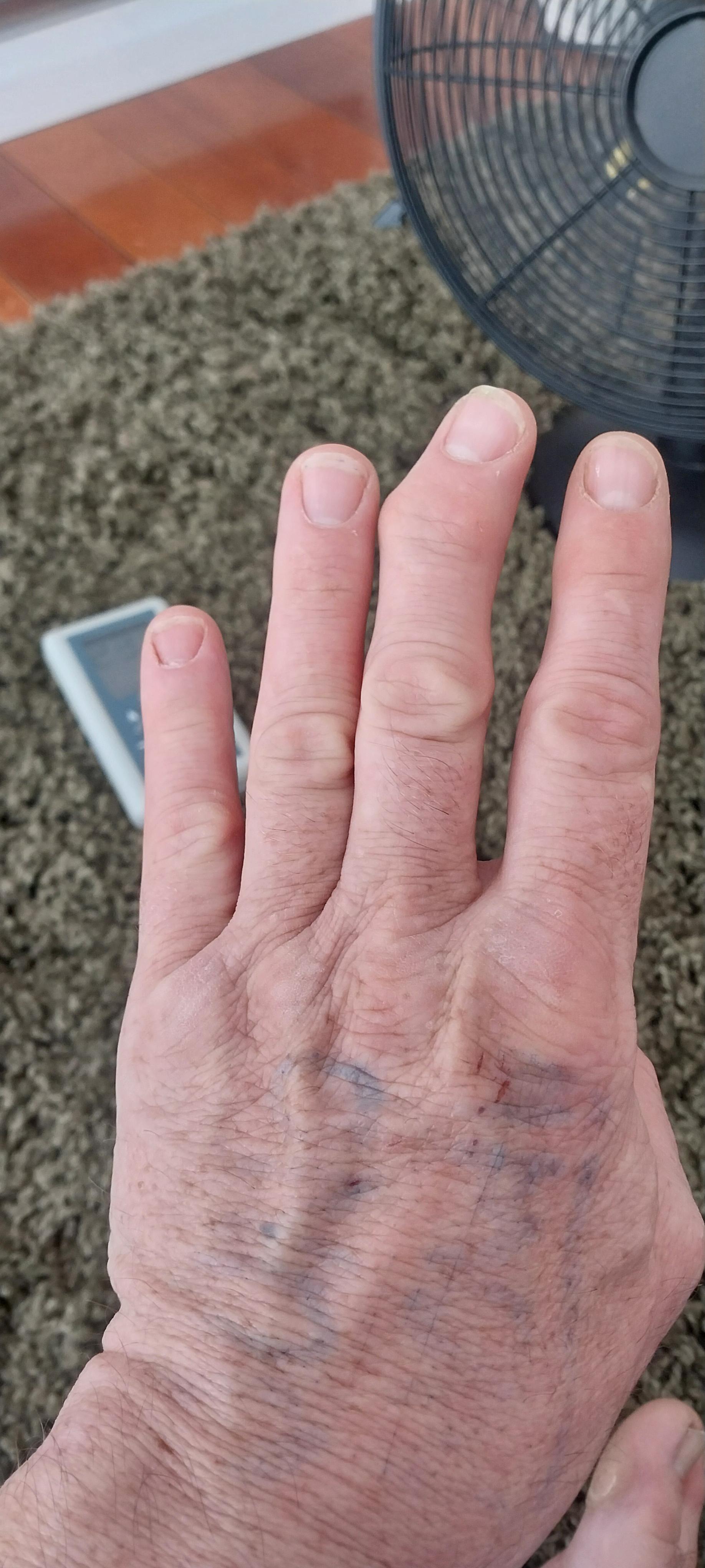 can you play guitar with long nails