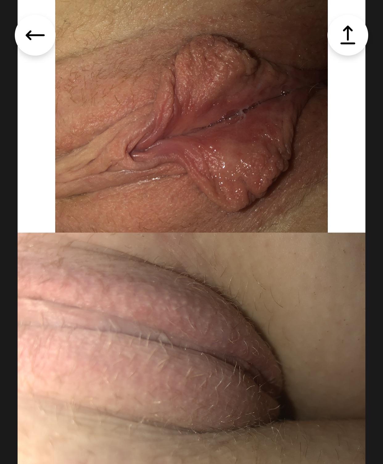 Slideshow innie vs outie pussy. 