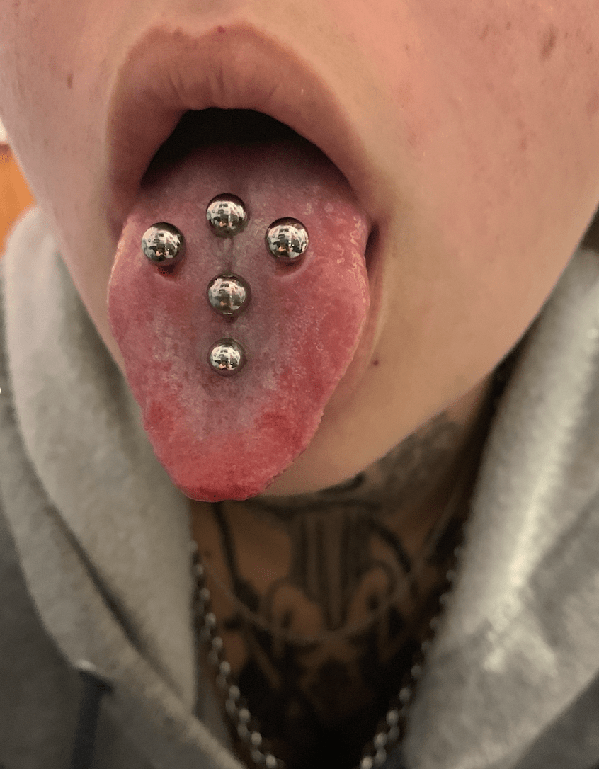 1 week healed venom bites next to 3 healed (bottom 2 are 2 years old and top one is 6 months old) : rbodymods Venom bites piercing