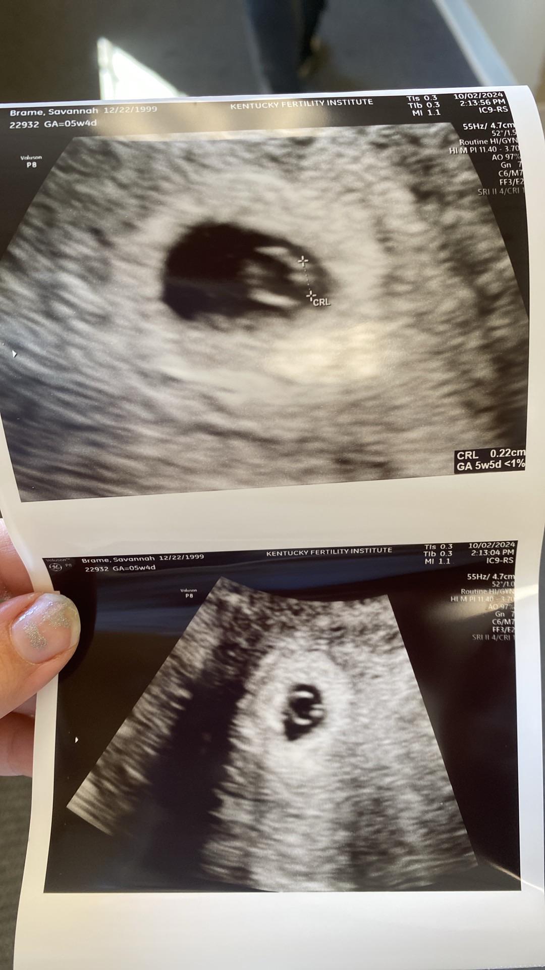 Went for our first ultrasound yesterday and it showed no embryo (4 weeks  pregnant post transfer) : rIVF