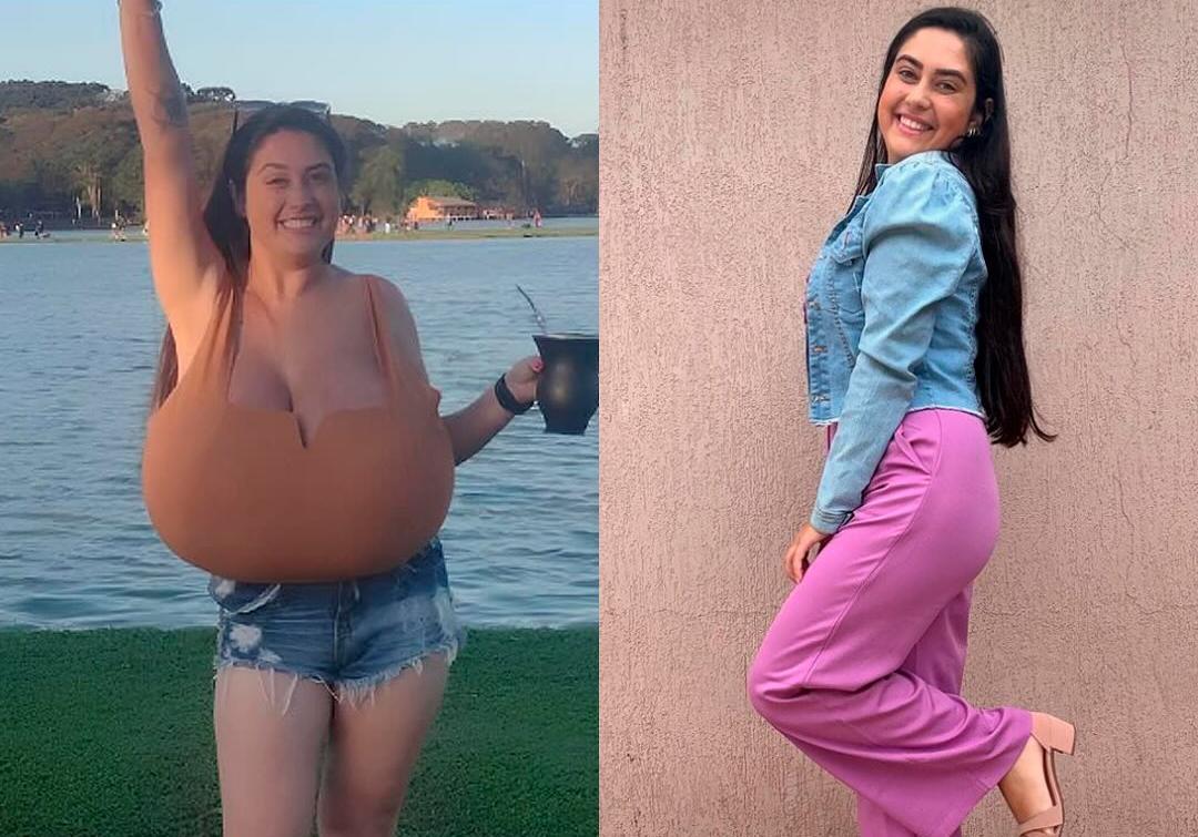 Gigantomastia huge tits