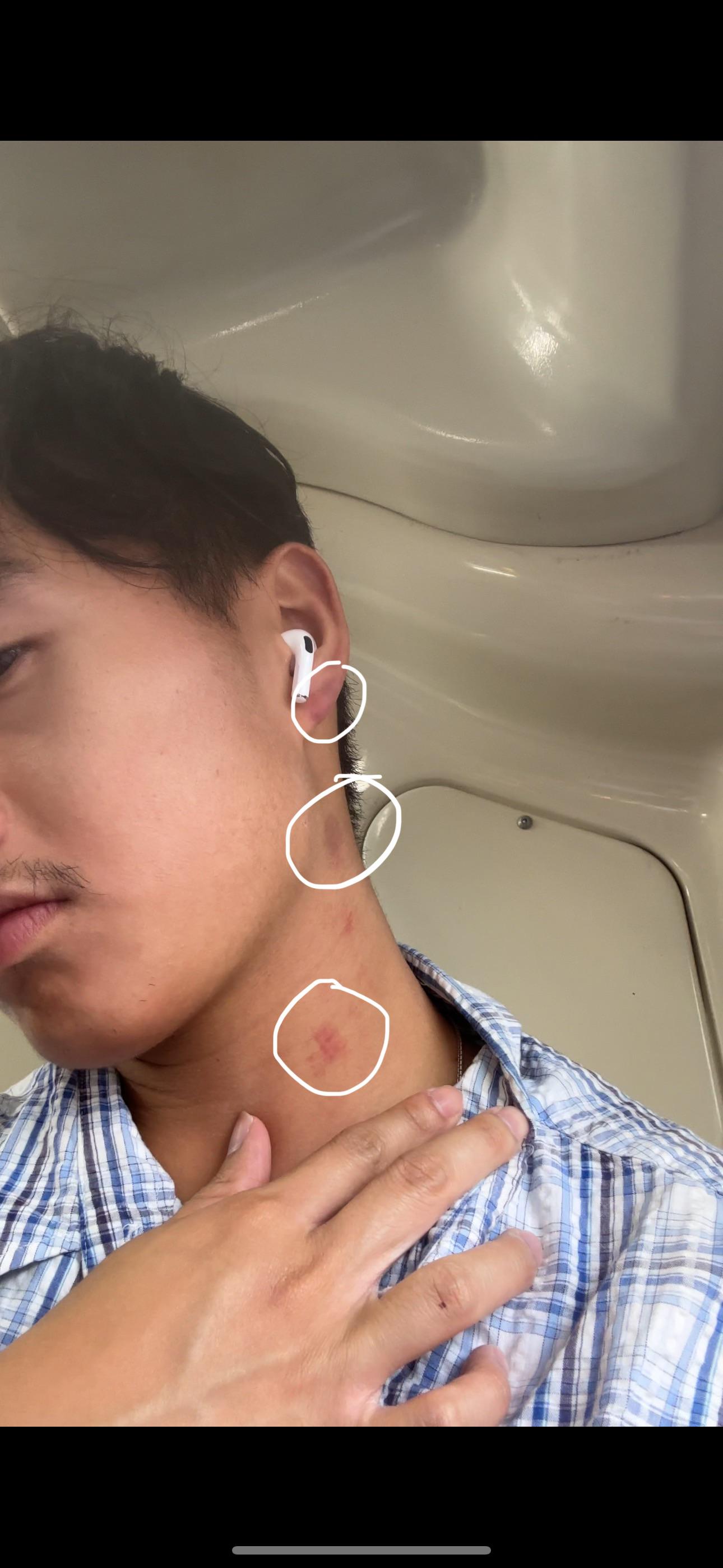 como dar um chupao no pescoço