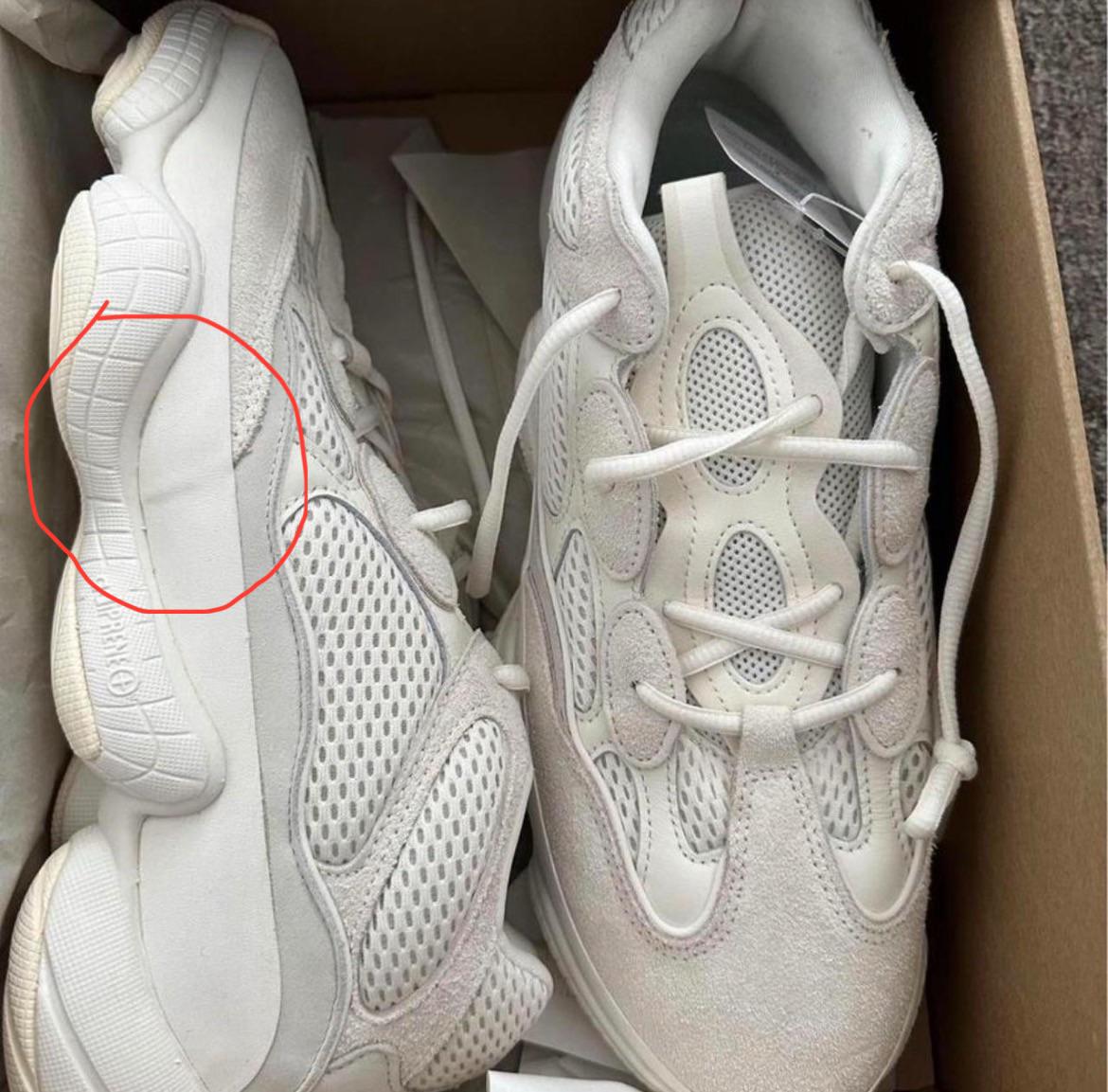 Это вот эта вена на члене на 500-х - это нормально, если что, вопрос без подвоха. : ryeezys Вены на члене