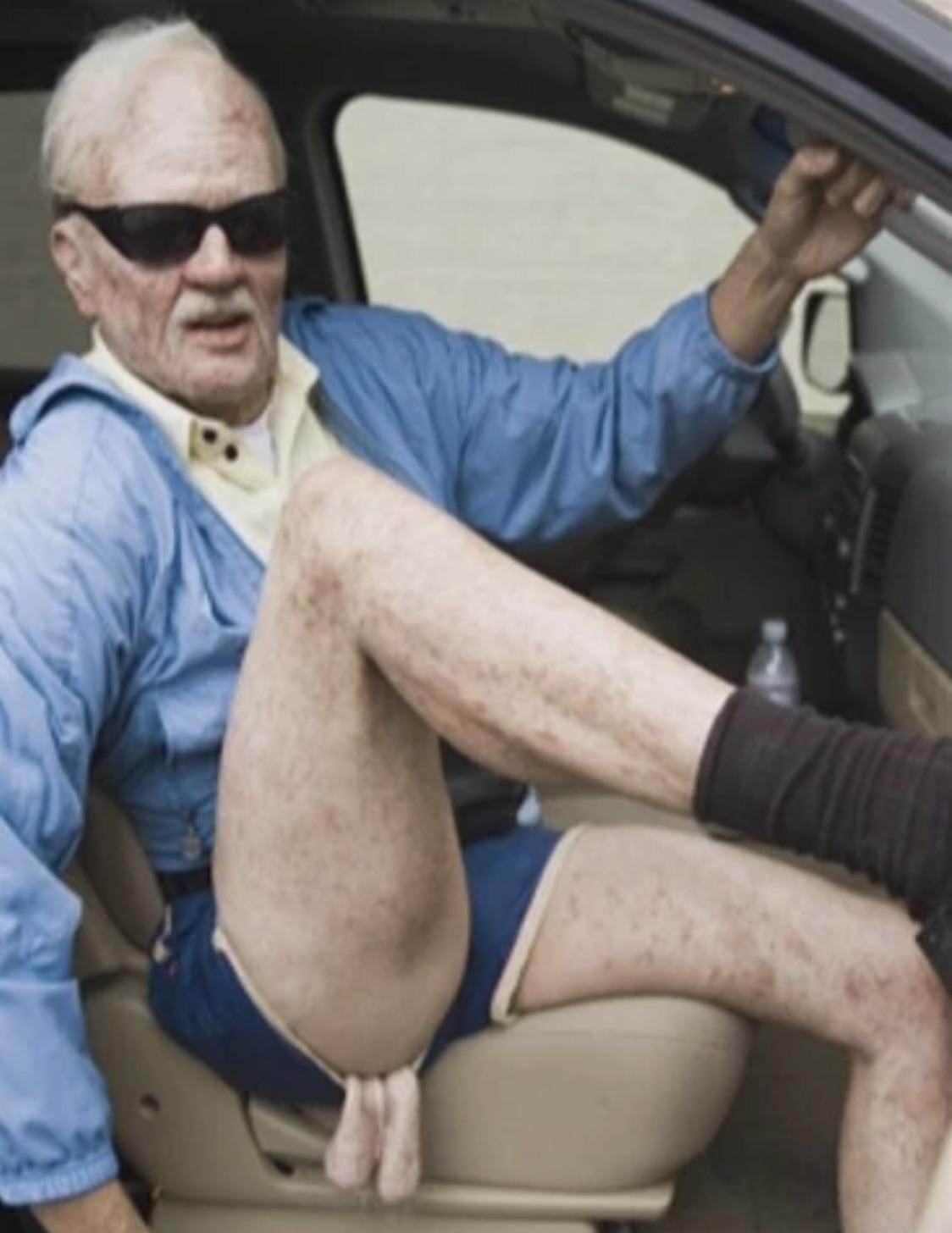 отвисшие яйца фото