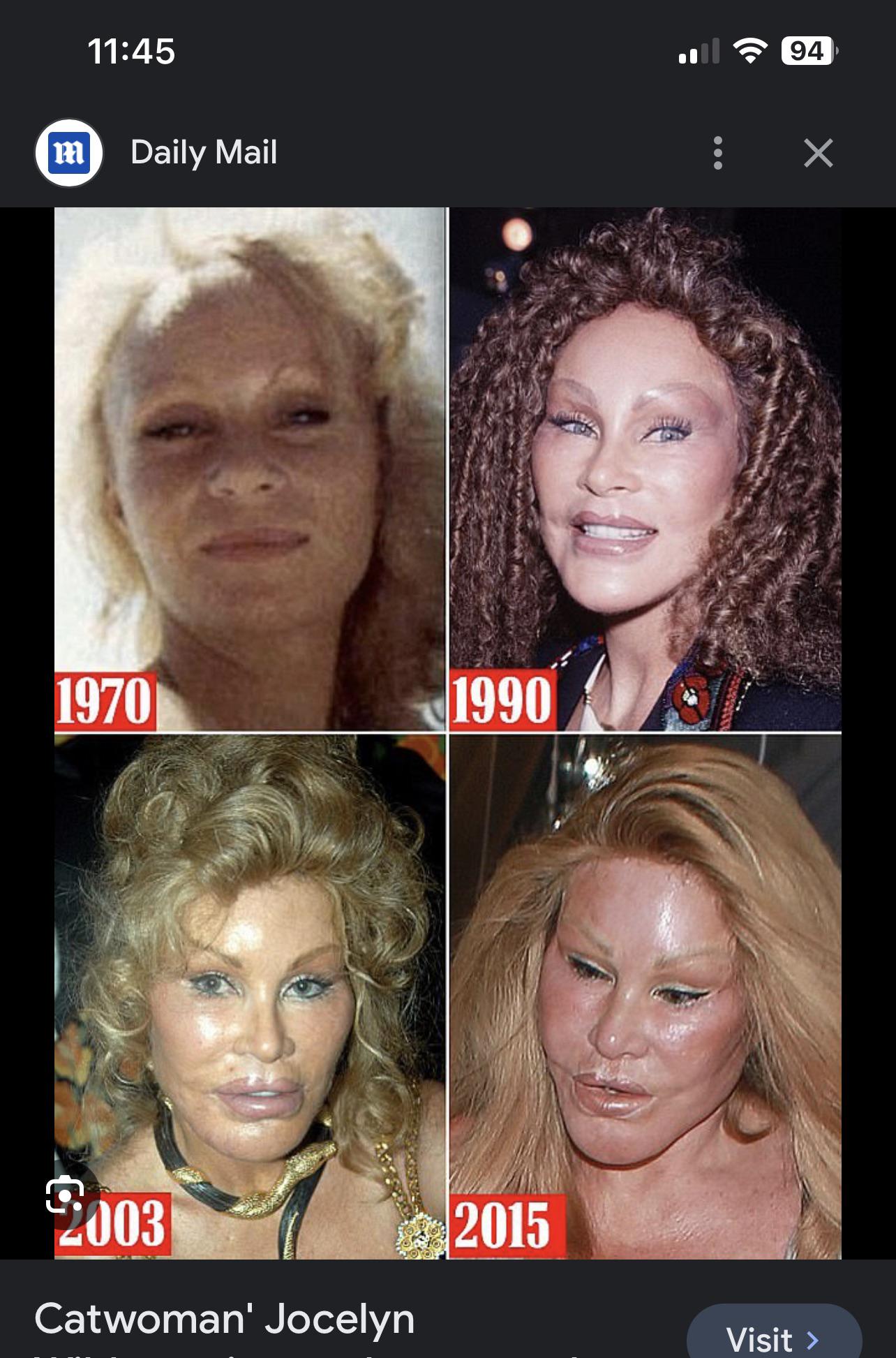 Farrahs latest surgery : rteenmom