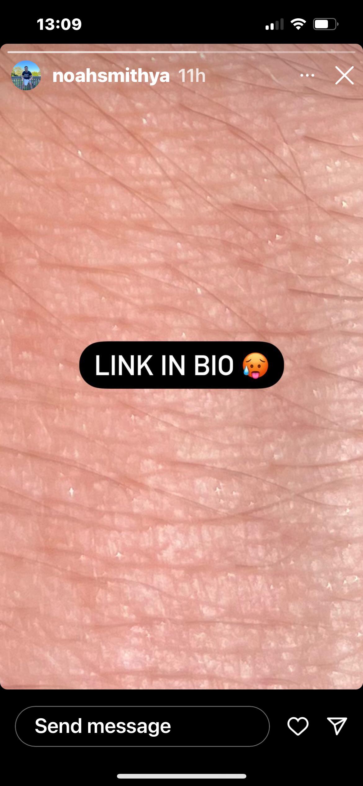 wheelchair rapunzel onlyfans