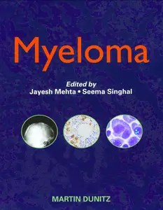 Myeloma