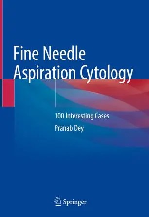 Fine Needle Aspiration Cytology 100 Interesting Cases (EPUB)
