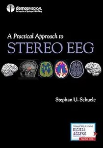 A Practical Approach to Stereo EEG