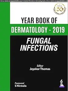 Fungal Infections