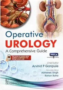 Operative Urology A Comprehensive Guide
