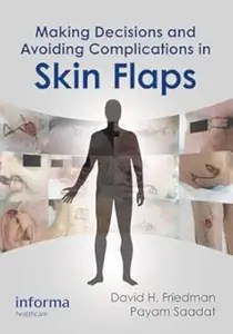 Making Decisions and Avoiding Complications in Skin Flaps