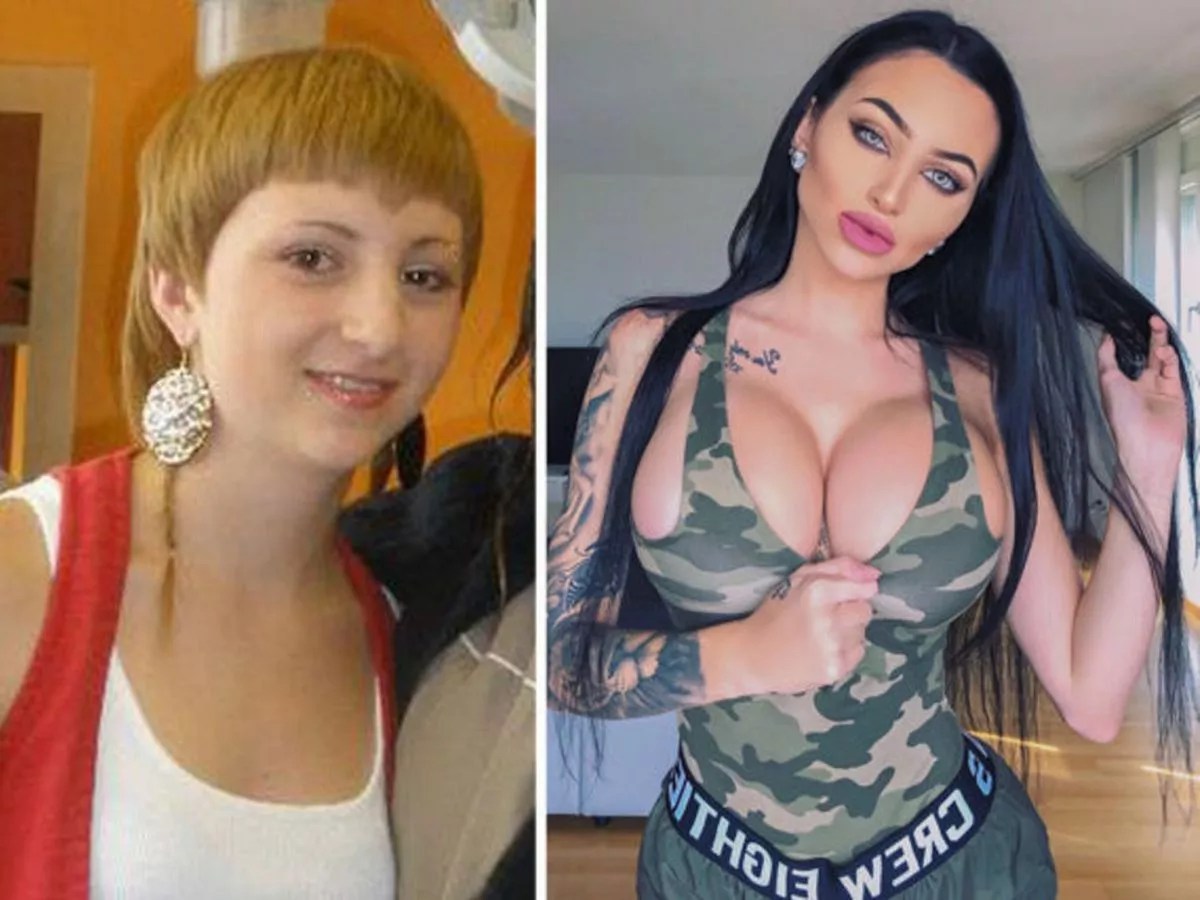 Bullied Instagram babe, 24, unveils JAW