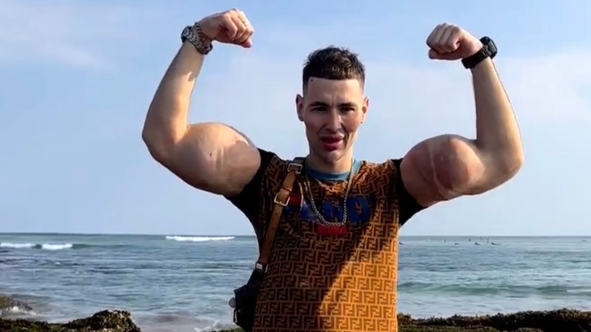 “Rus Temel Reis” kollarını kaybetmek üzere