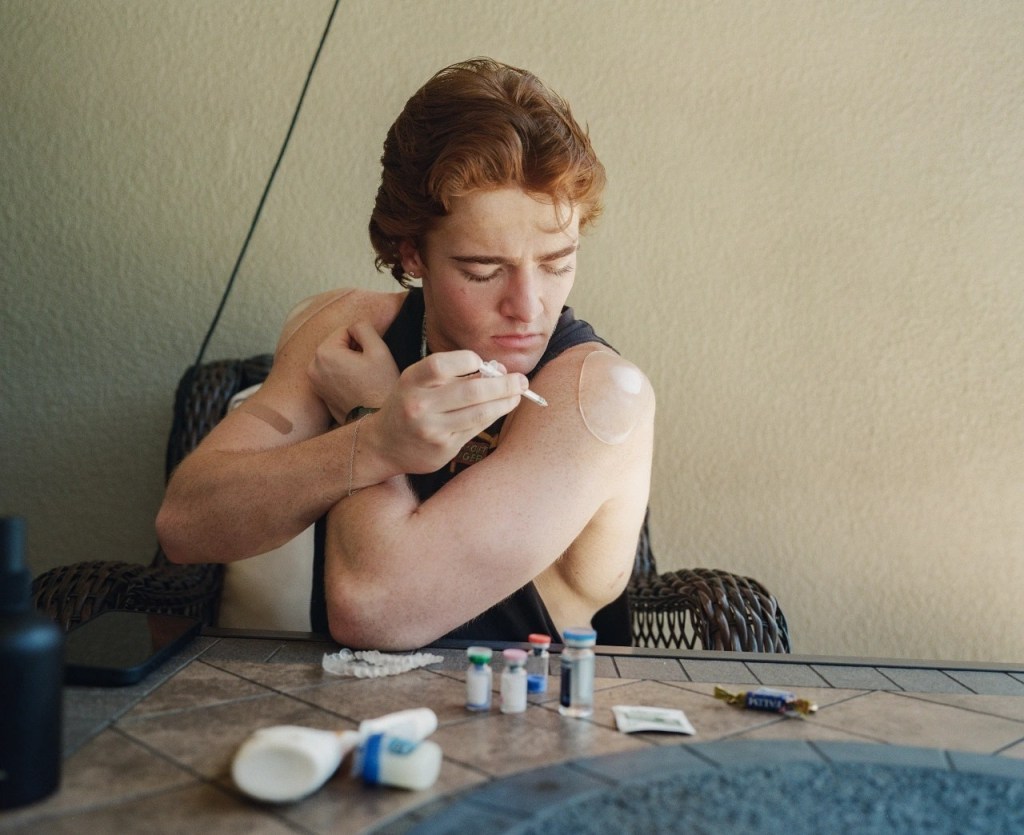 Young men are turning to peptides in search of perfection, hearing loss might be linked to walking speed and a quarantine ‘hotel’ got a new patient. Read more in this week’s WSJ Health newsletter: