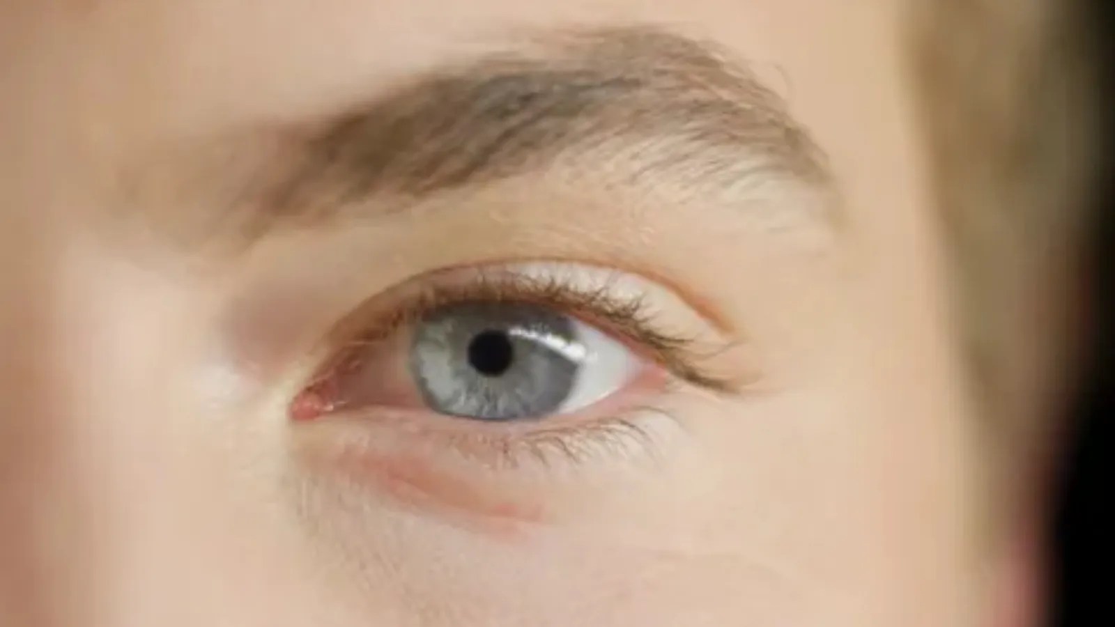 Here's Exactly When To Start Worrying About An Eye Twitch
