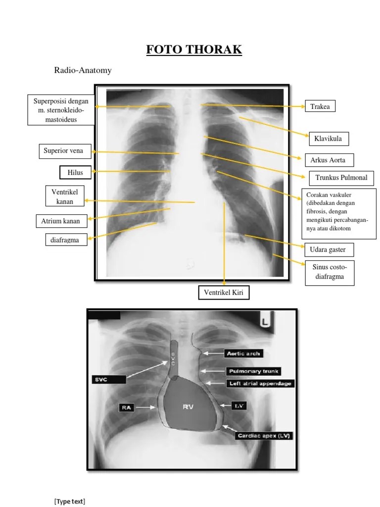 The Odyssey Radiology (CoAsst Guide Line) | PDF