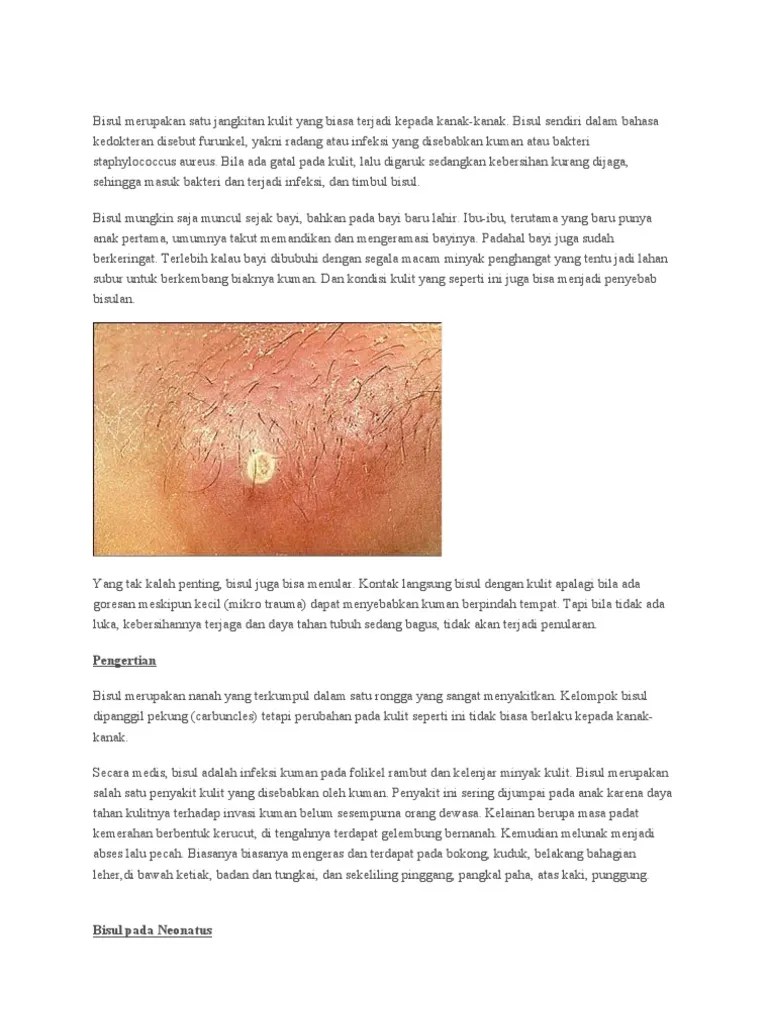 Bisul Merupakan Satu Jangkitan Kulit Yang Biasa Terjadi Kepada Kanak | PDF