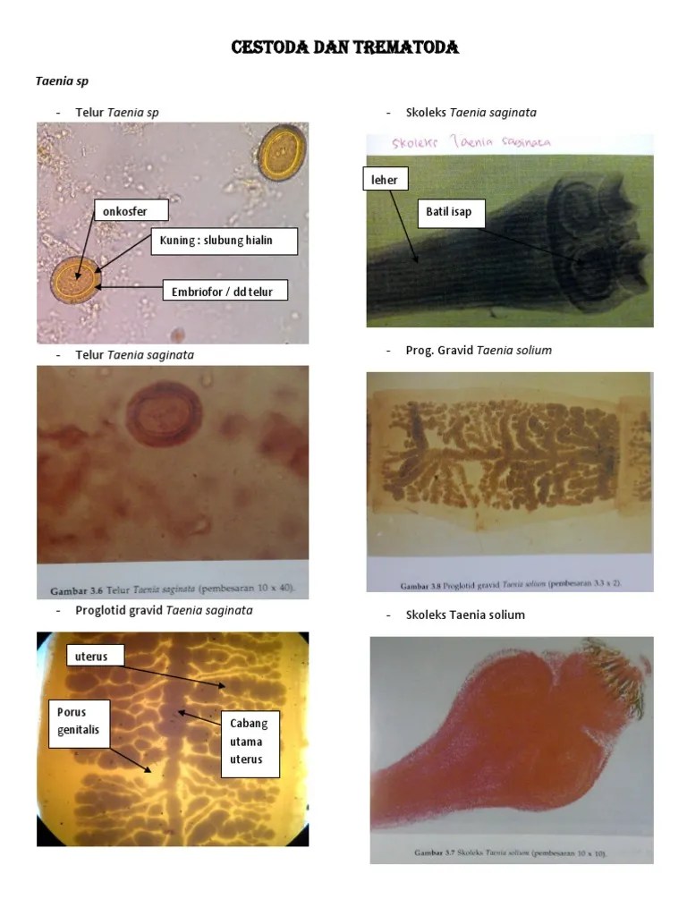 Cestoda Dan Trematoda | PDF