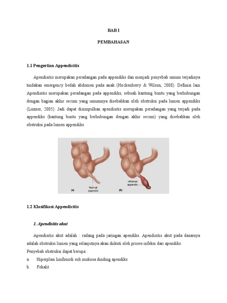 Appndicitis | PDF