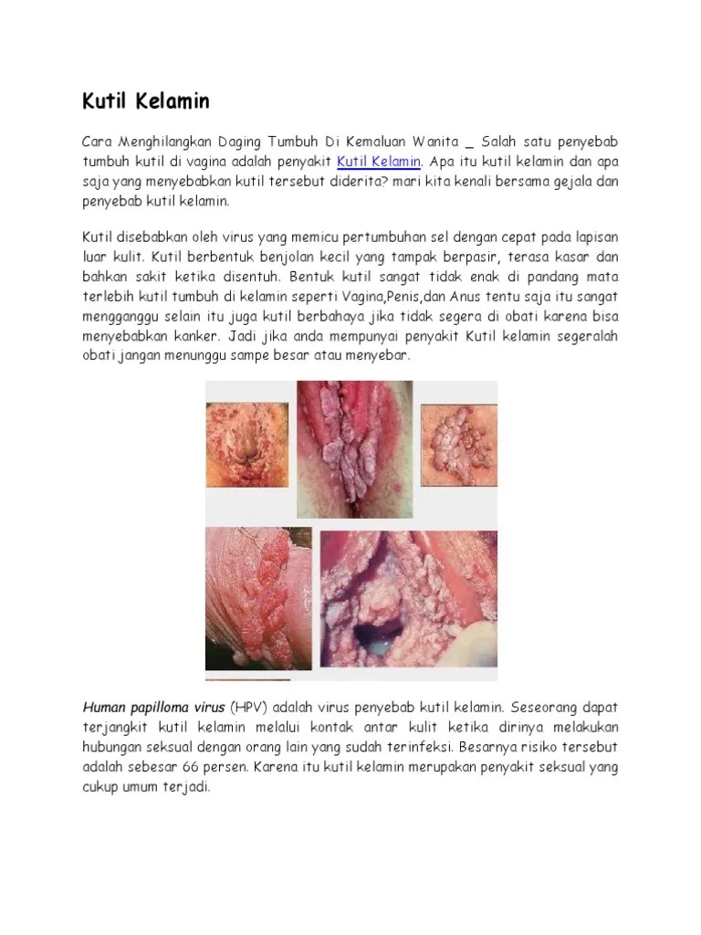Cara Menghilangkan Daging Tumbuh Di Kemaluan Wanita | PDF
