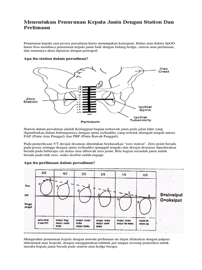 Menentukan Penurunan Kepala Janin Dengan Station Dan Perlimaan | PDF